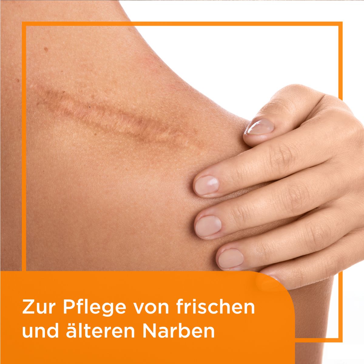 bepanthen-narben-gel-behandlung